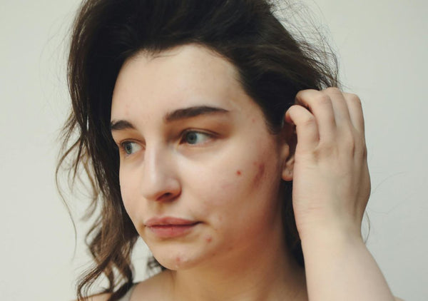 5 Stressed Skin Solutions To Soothe And Restore Your Complexion