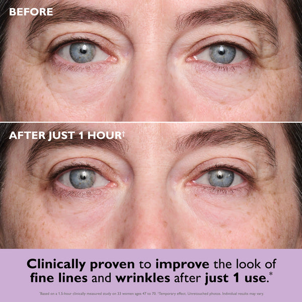 Peter Thomas Roth Instant FIRMx® Collagen Infusion Tightening Eye Patches 8 pairs
