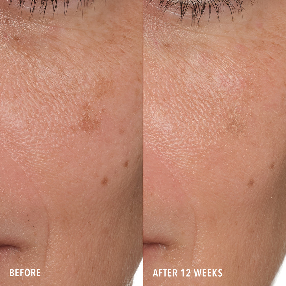 HydroPeptide Syner-C Before & After Tone & Texture
