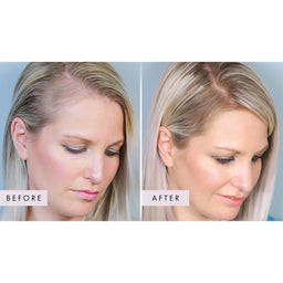 Hair Gain Capsules - 1 Month Supply