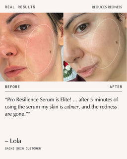 Sachi Skin Peptide Pro Resilience Serum Concentrate 30ml