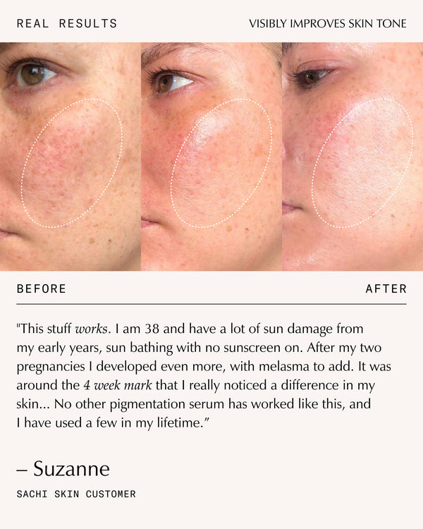 Sachi Skin Triphala Pigmentation Corrector 30ml