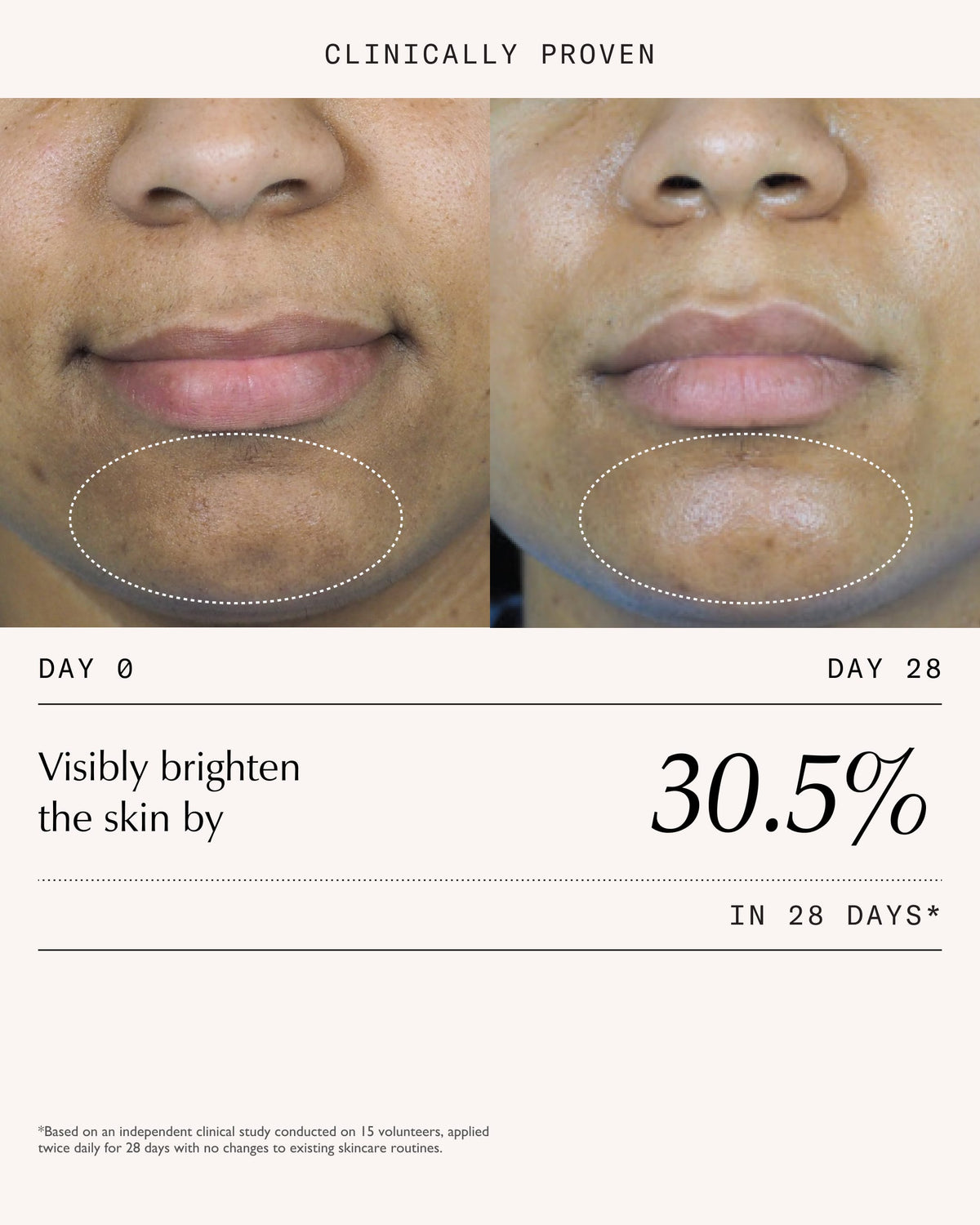 Sachi Skin Triphala Pigmentation Corrector 30ml