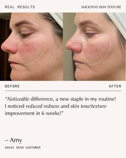 Sachi Skin Peptide Pro Resilience Serum Concentrate 30ml