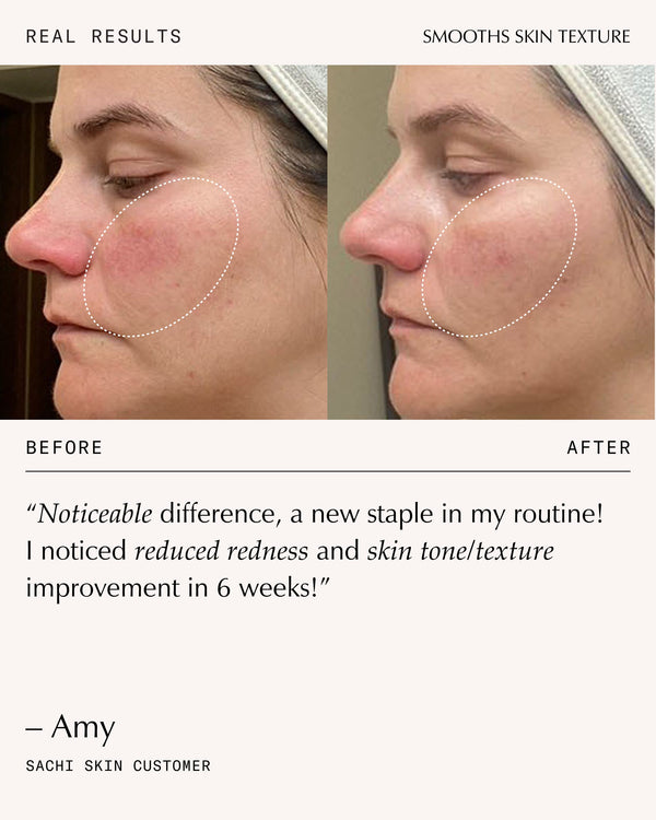 Sachi Skin Peptide Pro Resilience Serum Concentrate 30ml