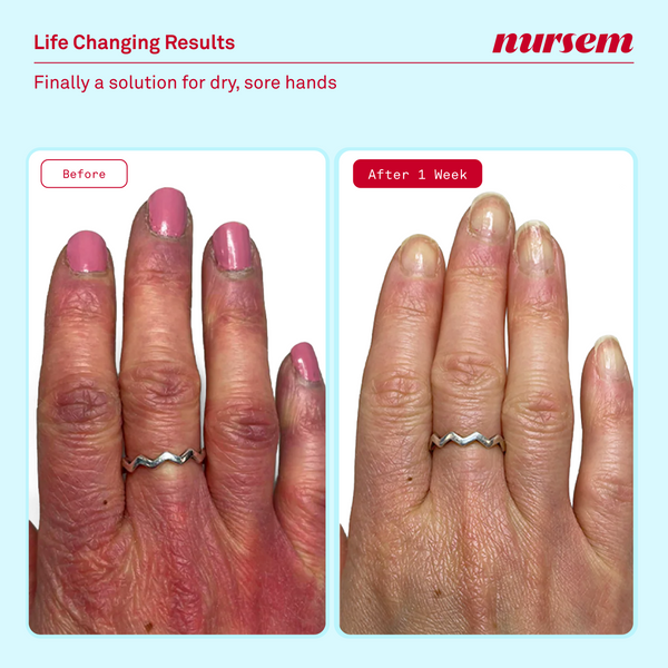 Nursem Caring Hand Cream 75ml
