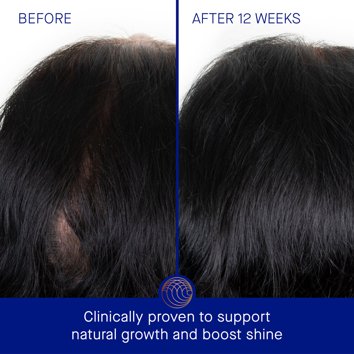 Augustinus Bader The Scalp Treatment