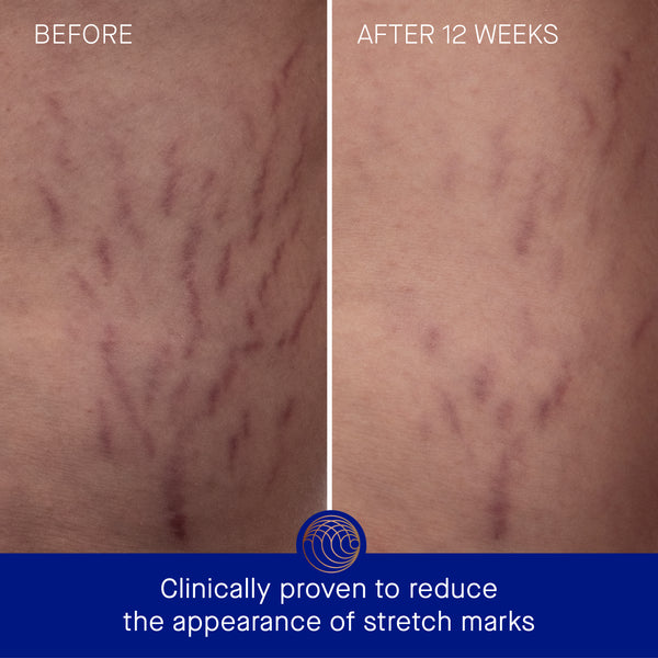 Augustinus Bader The Body Cream 100ml