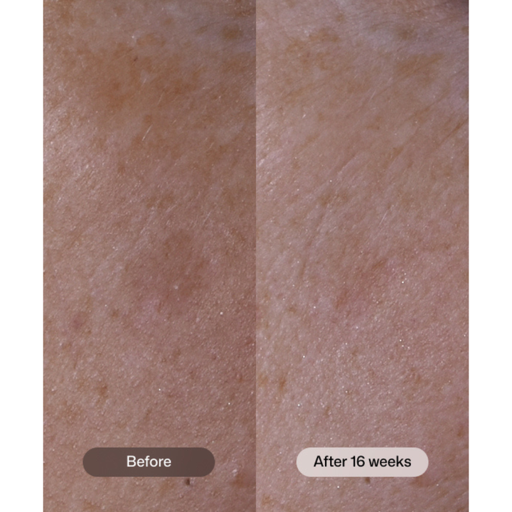 Revision Skincare Advanced Pigment Corrector+ 30g