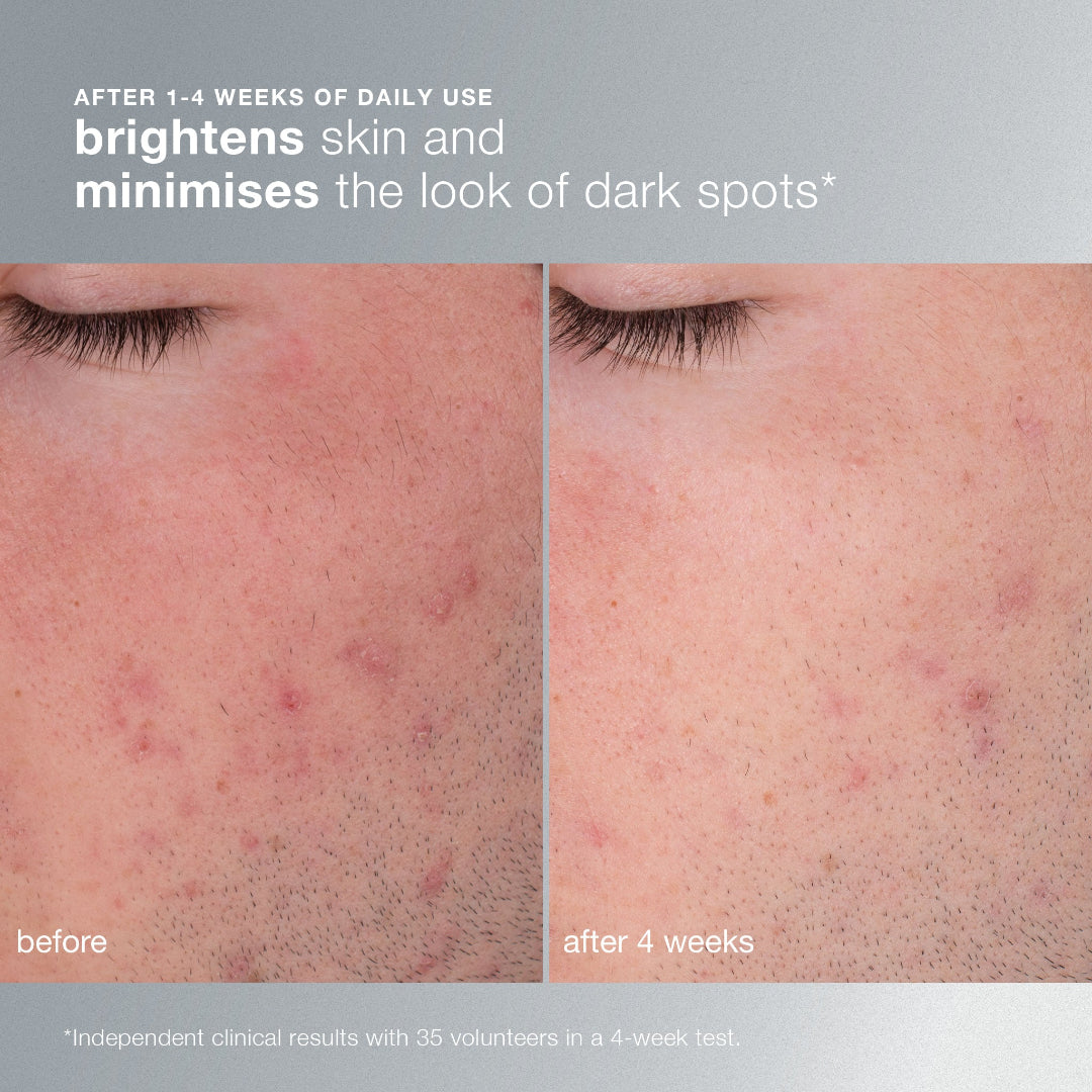 Before and after skin comparison showing brightening effect with text indicating results.