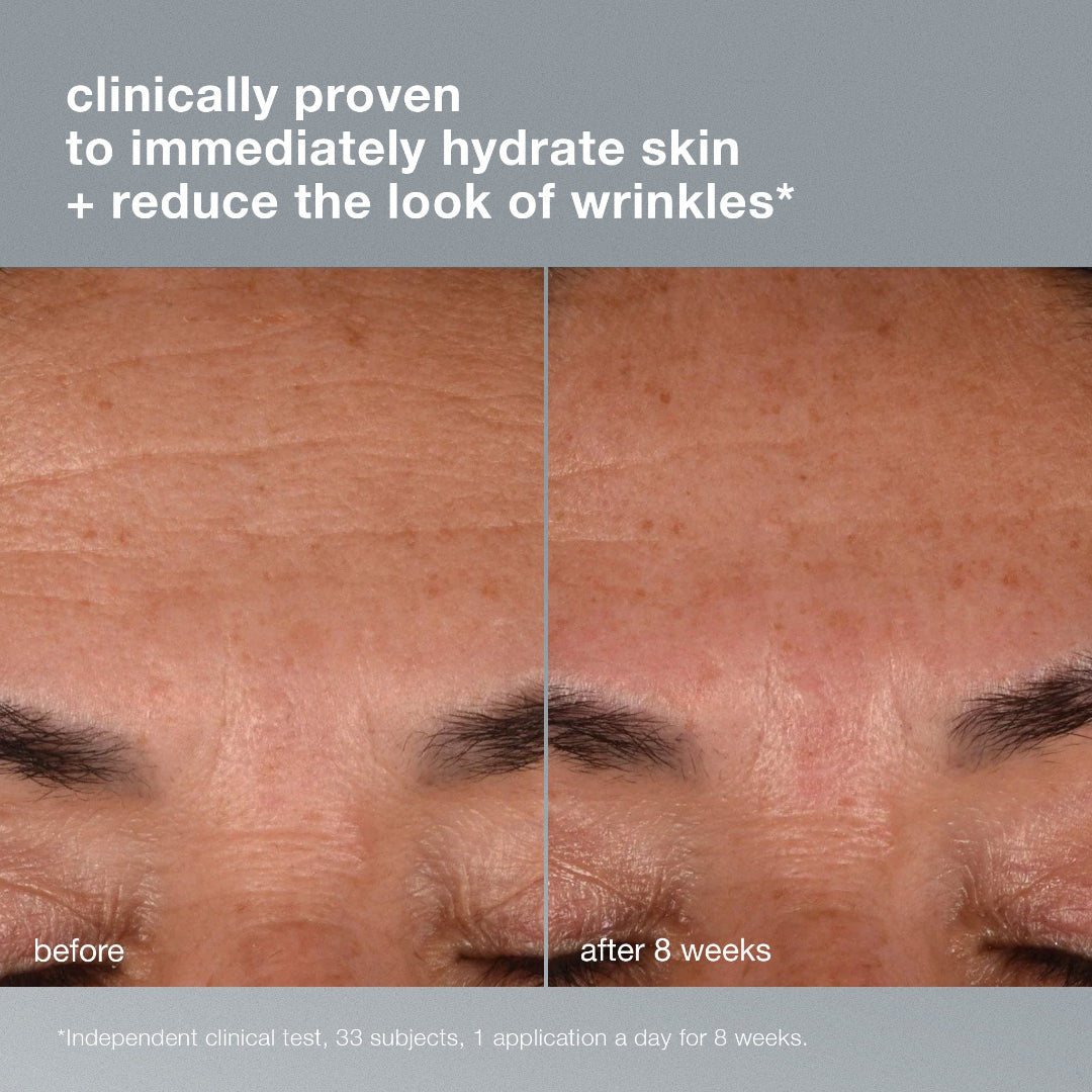 Before and after comparison of skin hydration with text indicating clinical proven results.