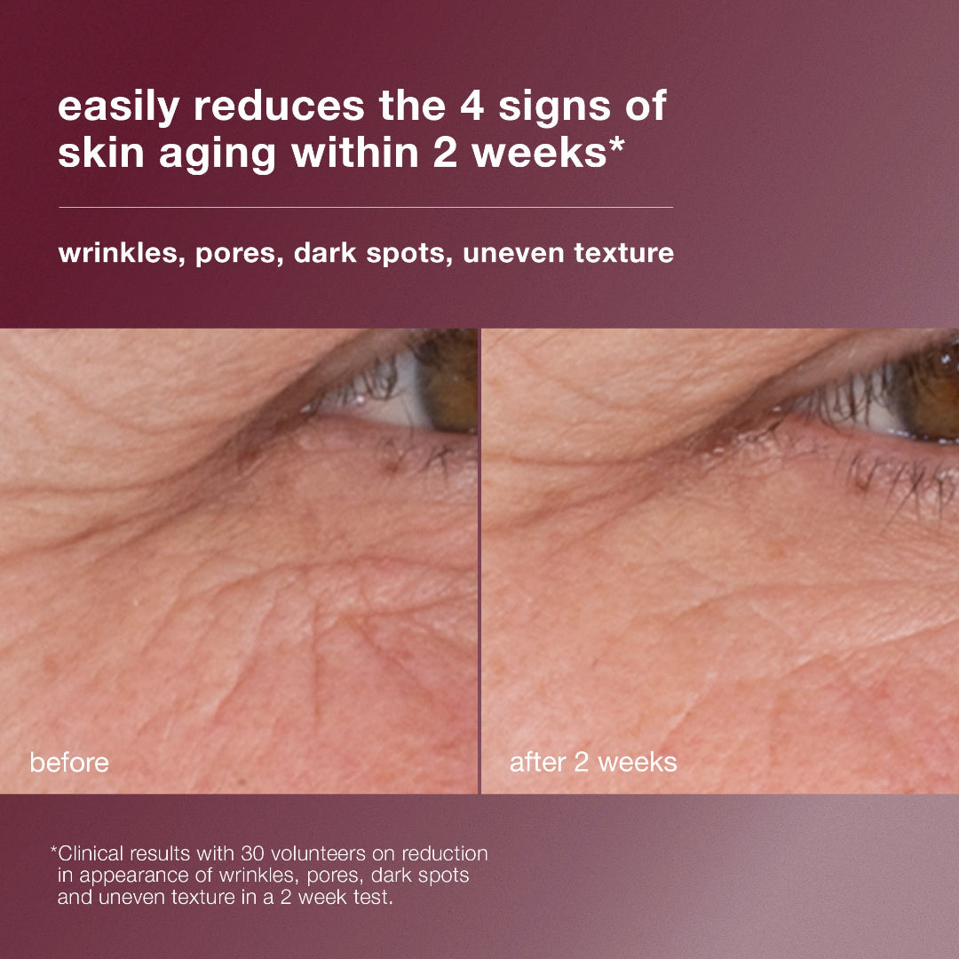 Before and after comparison of skin aging signs with text on a purple background