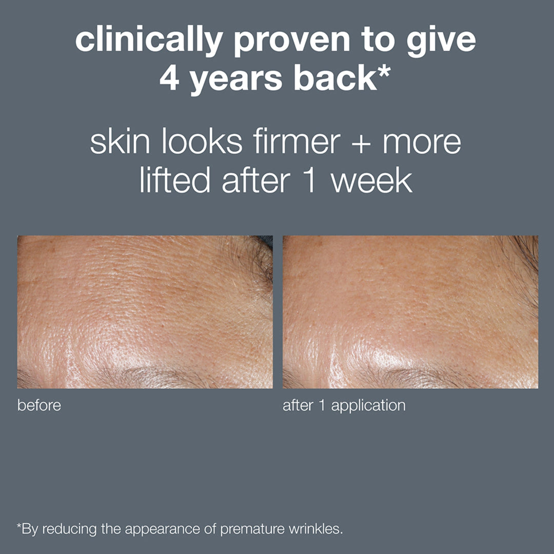 Before and after skin comparison with text claiming results after one week of use.