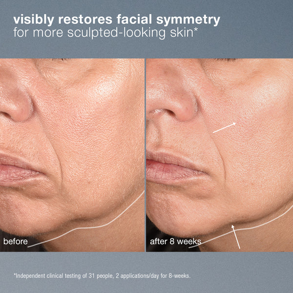 Before and after comparison of facial skin treatment showing restored symmetry.