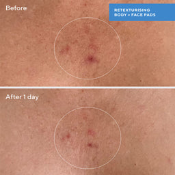 Murad Retexturizing Body Pads