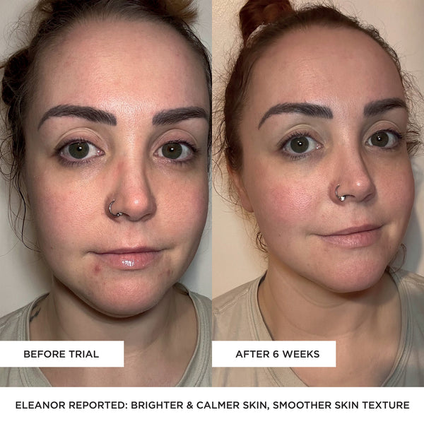 BEAUTYPRO LED Wand 5 In 1 Anti-Ageing Device