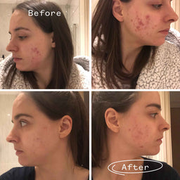 Pai Skincare Instant Kalmer Serum