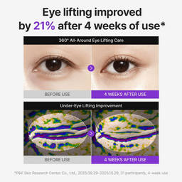 Before and after effects of eye lifting treatment with text indicating improvement and study details.