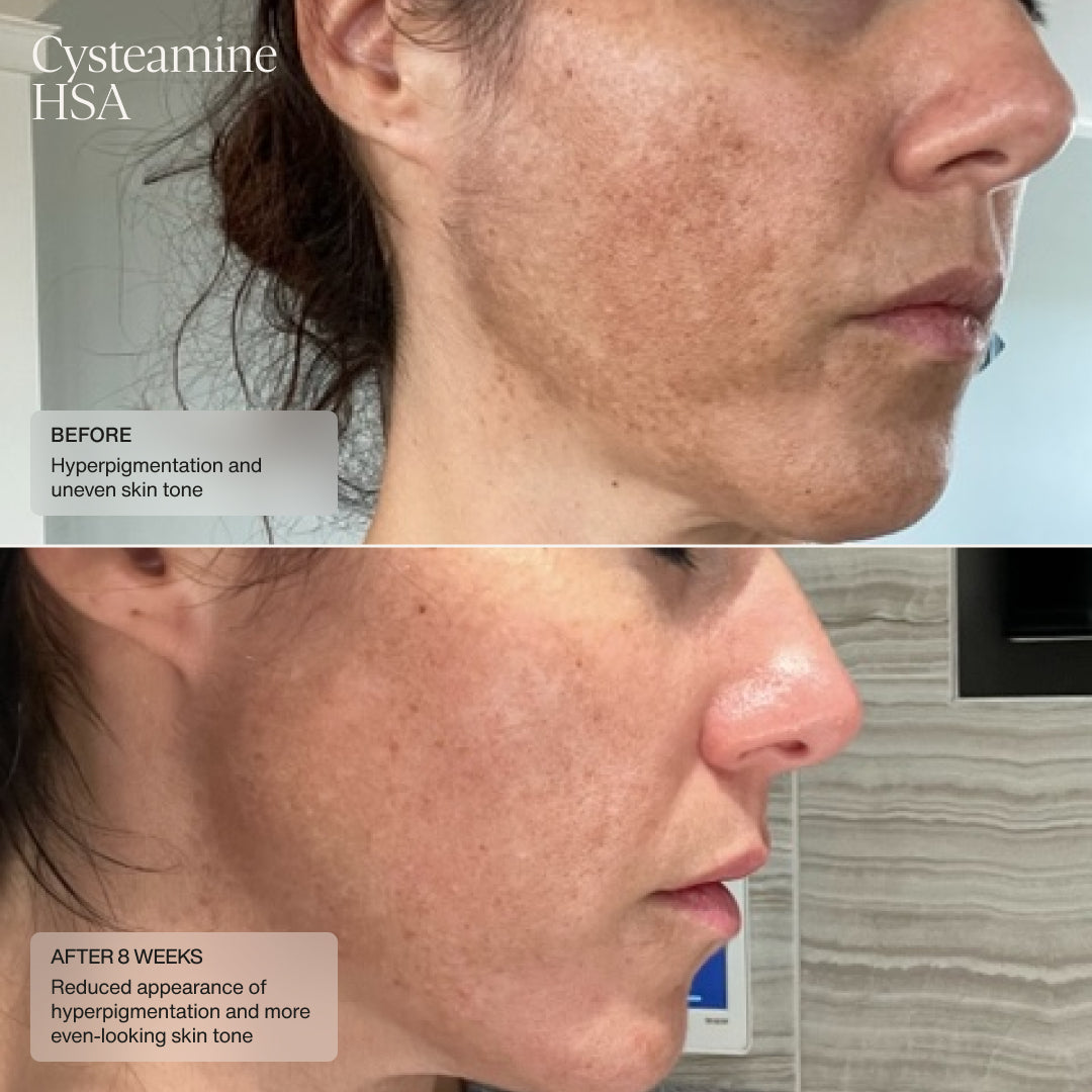 Senté Dermal Repair Kit