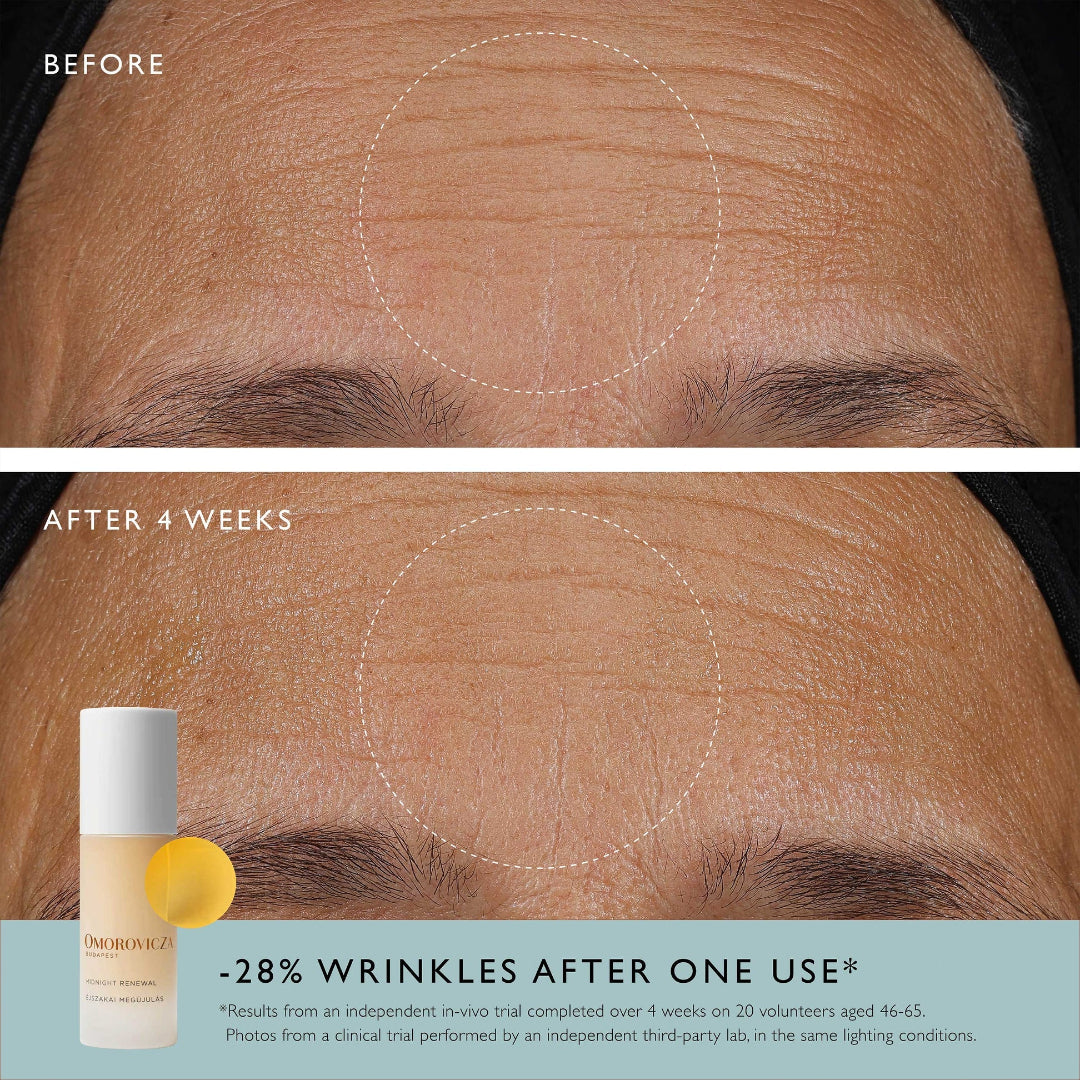 Before and after comparison of skin with wrinkles, showing a skincare product used.