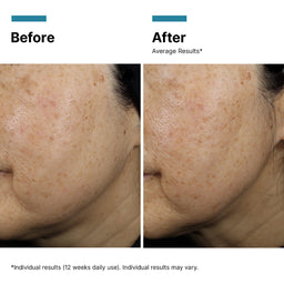 SkinCeuticals A.G.E. Interrupter Ultra Serum 30ml