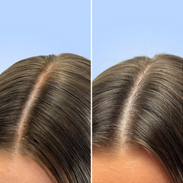 Side-by-side comparison of hair with and without gray hair strands on a blue background