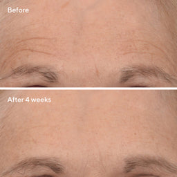 Murad Retinal ReSculpt Overnight Treatment