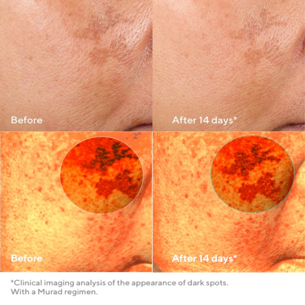 Murad Rapid Dark Spot Correcting Serum
