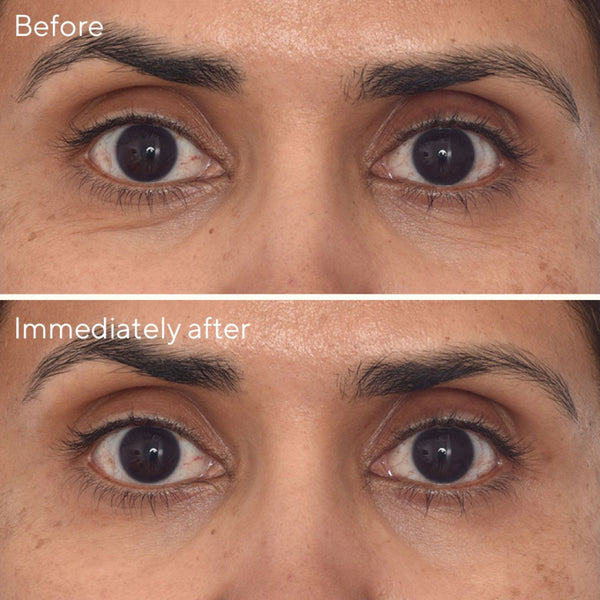 Retinol Youth Renewal Eye Mask - Single Pack