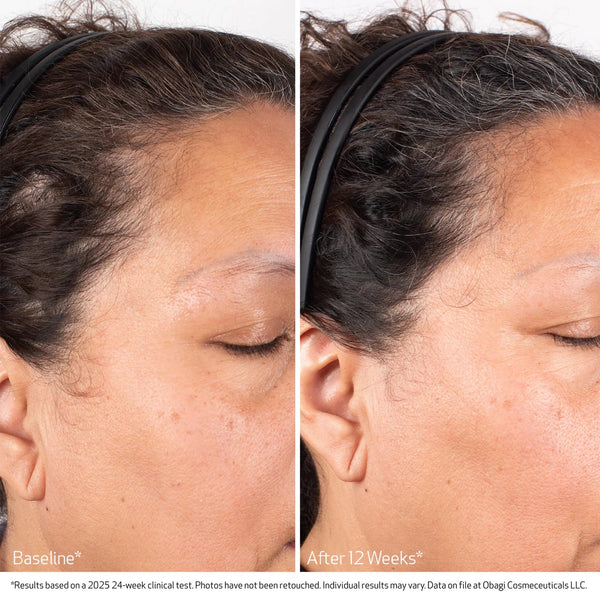 Obagi Nu-Cil Biostim Scalp Serum