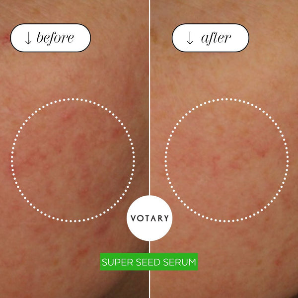 VOTARY Super Seed Serum- Broccoli Seed and Peptides Fragrance Free