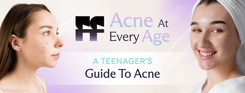 teenage acne