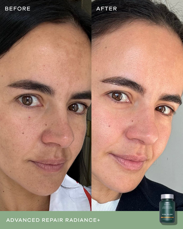 Vida Glow Radiance+ Supplement