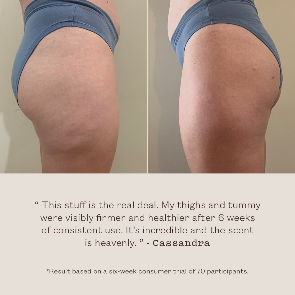 Before and after comparison of thighs with text from a consumer about product effectiveness.