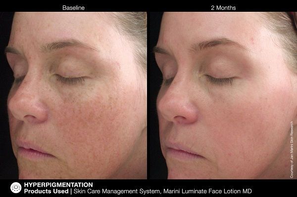before and .after using the product