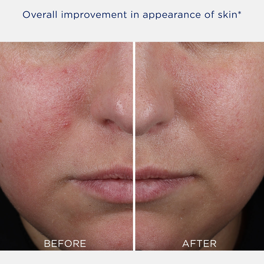NeoStrata Mandelic Clarifying Hydragel