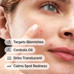 Close-up of a person's face with acne, showing text about skincare product benefits.